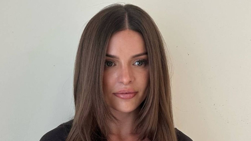 Influencer Blows £39,000 on Three Surgeries After Turkey Nose Job Nightmare