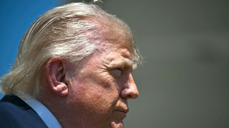 Trump's Hairline Crisis: Viral 'Rat Tails' Spark Health Concerns