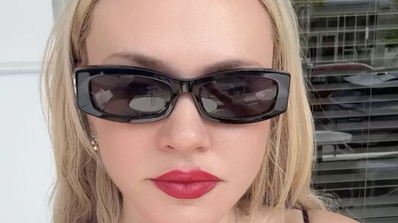 Influencer Found Dead in Luxury Hotel After Cosmetic Surgery: Shocking Details Emerge