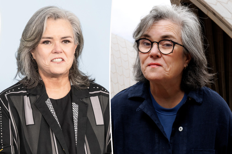Rosie O’Donnell’s Facelift: From Awkward Comments to Shocking Transformation