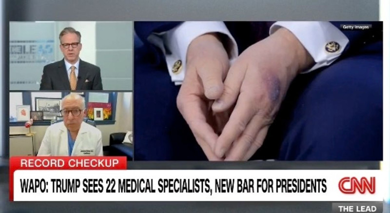 Trump's 'Mannequin Hand' Sparks Health Alarm as Disturbing Mark Emerges