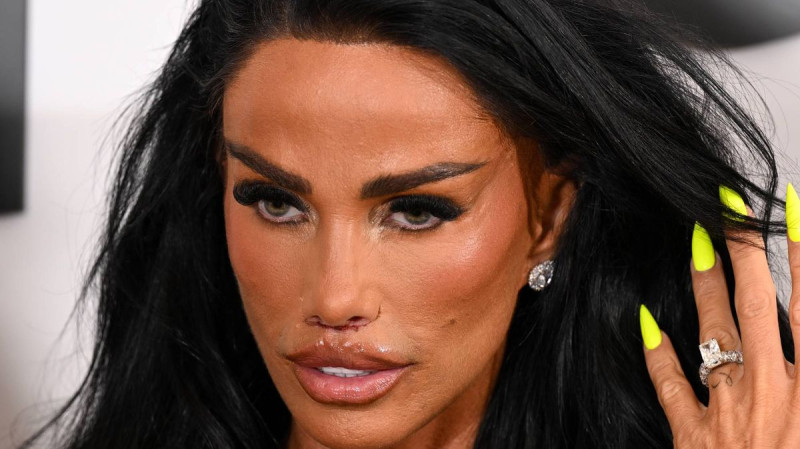 Katie Price Shows Up Bloodied and Bruised for Daughter's Show, Shocking Crew