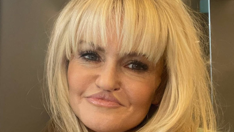 Danniella Westbrook Shows Off Shocking Results of Latest Facial Reconstruction Surgery